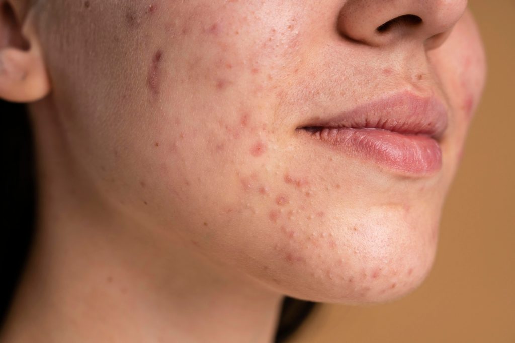 skin whitening treatment in malaysia