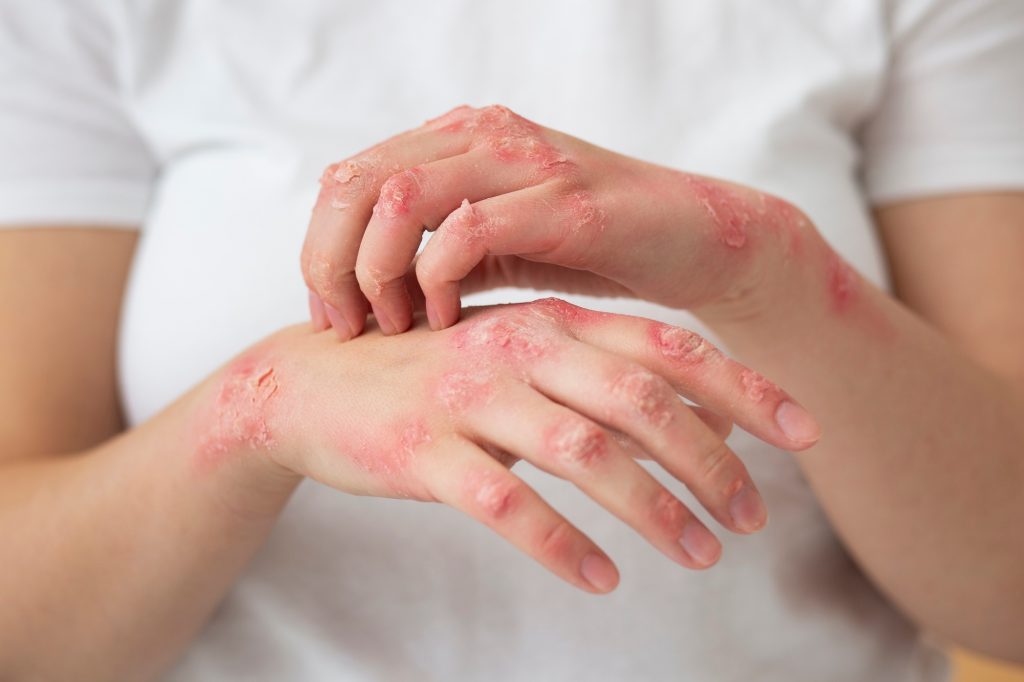 skin whitening treatment in malaysia