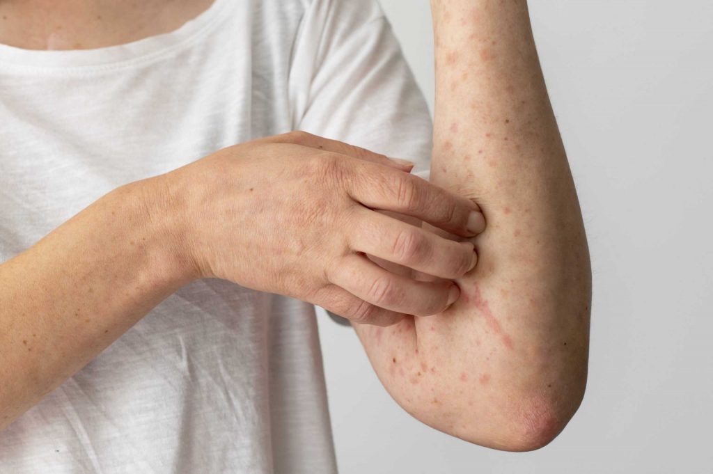 skin whitening treatment in malaysia