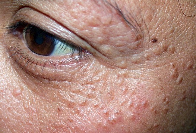 facial treatment clinic