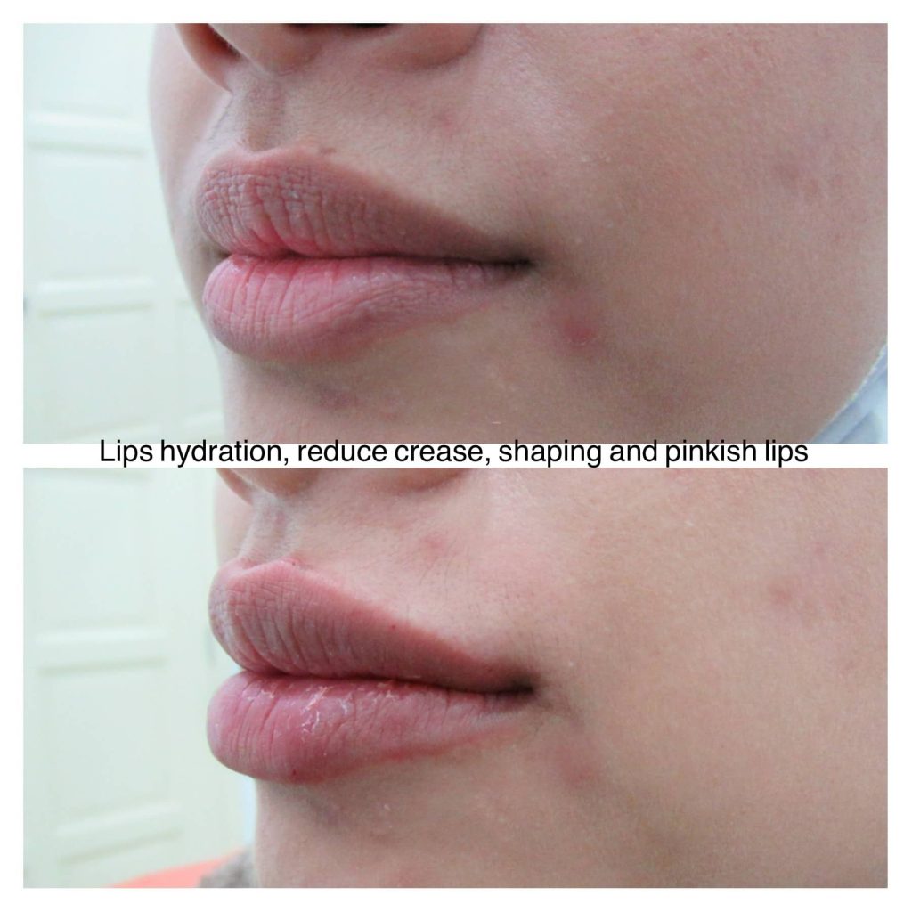 facial treatment clinic